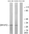 Olfactory Receptor Family 10 Subfamily T Member 2 antibody, GTX87302, GeneTex, Western Blot image 