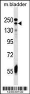 Adenylate Cyclase 9 antibody, 59-496, ProSci, Western Blot image 