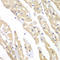Chaperonin Containing TCP1 Subunit 3 antibody, LS-C334788, Lifespan Biosciences, Immunohistochemistry paraffin image 