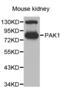 P21 (RAC1) Activated Kinase 1 antibody, abx002331, Abbexa, Western Blot image 