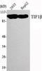 Tripartite Motif Containing 28 antibody, STJ98563, St John