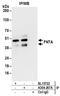 Farnesyltransferase, CAAX Box, Alpha antibody, A304-267A, Bethyl Labs, Immunoprecipitation image 