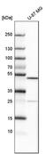 AlkB Homolog 5, RNA Demethylase antibody, PA5-52401, Invitrogen Antibodies, Western Blot image 