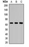 Solute Carrier Family 22 Member 5 antibody, LS-C668109, Lifespan Biosciences, Western Blot image 