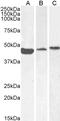 Actin Alpha 2, Smooth Muscle antibody, 45-198, ProSci, Immunofluorescence image 