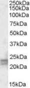 ADP Ribosylation Factor Like GTPase 4D antibody, TA305789, Origene, Western Blot image 