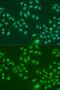 Interferon Induced Protein With Tetratricopeptide Repeats 3 antibody, GTX33255, GeneTex, Immunocytochemistry image 