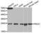 Peroxiredoxin 1 antibody, abx001522, Abbexa, Western Blot image 