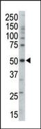 Protein Kinase AMP-Activated Non-Catalytic Subunit Gamma 3 antibody, PA5-13797, Invitrogen Antibodies, Western Blot image 