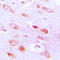 AKT Serine/Threonine Kinase 2 antibody, LS-C351826, Lifespan Biosciences, Immunohistochemistry paraffin image 