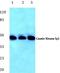 Casein Kinase 1 Gamma 1 antibody, PA5-36284, Invitrogen Antibodies, Western Blot image 