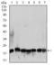 Ribosomal Protein L18a antibody, GTX60728, GeneTex, Western Blot image 