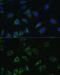 SRP Receptor Subunit Beta antibody, GTX64995, GeneTex, Immunofluorescence image 