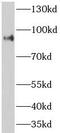 Activating Signal Cointegrator 1 Complex Subunit 2 antibody, FNab00628, FineTest, Western Blot image 