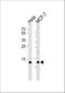 Ring-Box 1 antibody, A00524-1, Boster Biological Technology, Western Blot image 