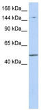 PR/SET Domain 15 antibody, TA338909, Origene, Western Blot image 