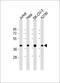 Globoside Alpha-1,3-N-Acetylgalactosaminyltransferase 1 (FORS Blood Group) antibody, 61-253, ProSci, Western Blot image 