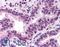 Nuclear Transcription Factor Y Subunit Alpha antibody, LS-B131, Lifespan Biosciences, Immunohistochemistry paraffin image 
