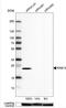 RAB13, Member RAS Oncogene Family antibody, NBP1-85799, Novus Biologicals, Western Blot image 