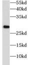 Phosphoglycerate Mutase 1 antibody, abx236345, Abbexa, Western Blot image 