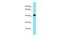 Chromosome 8 Open Reading Frame 76 antibody, A18933, Boster Biological Technology, Western Blot image 