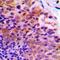 Programmed Cell Death 4 antibody, orb256744, Biorbyt, Immunohistochemistry paraffin image 