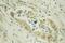 Adenylate Kinase 3 antibody, 12562-1-AP, Proteintech Group, Immunohistochemistry paraffin image 