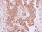 Pim-2 Proto-Oncogene, Serine/Threonine Kinase antibody, NBP1-33731, Novus Biologicals, Immunohistochemistry paraffin image 