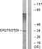Olfactory Receptor Family 2 Subfamily T Member 29 antibody, A17736, Boster Biological Technology, Western Blot image 