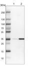 Sushi Domain Containing 6 antibody, NBP1-85931, Novus Biologicals, Western Blot image 