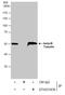 Tubulin Beta 3 Class III antibody, GTX631836, GeneTex, Immunoprecipitation image 