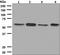 Cytochrome P450 Family 19 Subfamily A Member 1 antibody, ab124776, Abcam, Western Blot image 