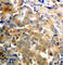 Protein Kinase C Zeta antibody, AP0433, ABclonal Technology, Immunohistochemistry paraffin image 