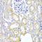 UPF2 Regulator Of Nonsense Mediated MRNA Decay antibody, LS-C748461, Lifespan Biosciences, Immunohistochemistry paraffin image 