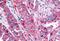 Adhesion G Protein-Coupled Receptor B2 antibody, MBS244848, MyBioSource, Immunohistochemistry paraffin image 