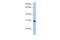 Carbohydrate Sulfotransferase 14 antibody, A07651, Boster Biological Technology, Western Blot image 