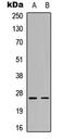 Complement C1q C Chain antibody, abx133183, Abbexa, Western Blot image 