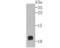 Ring-Box 1 antibody, NBP2-75643, Novus Biologicals, Western Blot image 