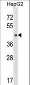 Keratin 23 antibody, LS-C160020, Lifespan Biosciences, Western Blot image 