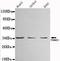 Proteasome Activator Subunit 3 antibody, LS-C178263, Lifespan Biosciences, Western Blot image 