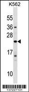 Interferon Alpha 10 antibody, 59-293, ProSci, Western Blot image 
