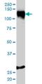 Stromal Antigen 1 antibody, H00010274-M01, Novus Biologicals, Western Blot image 