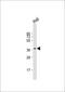 Ras Association Domain Family Member 2 antibody, MA5-24746, Invitrogen Antibodies, Western Blot image 