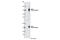 Slingshot Protein Phosphatase 1 antibody, 13578S, Cell Signaling Technology, Western Blot image 