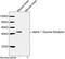 Glycine Receptor Alpha 1 antibody, LS-B13697, Lifespan Biosciences, Western Blot image 