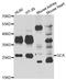 Gastrin cell antibody, STJ29166, St John