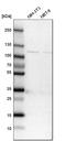 Isoleucyl-tRNA synthetase, mitochondrial antibody, HPA024596, Atlas Antibodies, Western Blot image 