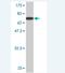 Eukaryotic Translation Initiation Factor 5 antibody, H00001983-M02, Novus Biologicals, Western Blot image 