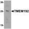 Transmembrane Protein 192 antibody, NBP2-82029, Novus Biologicals, Western Blot image 