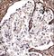 Desmoglein 2 antibody, LS-C167543, Lifespan Biosciences, Immunohistochemistry paraffin image 